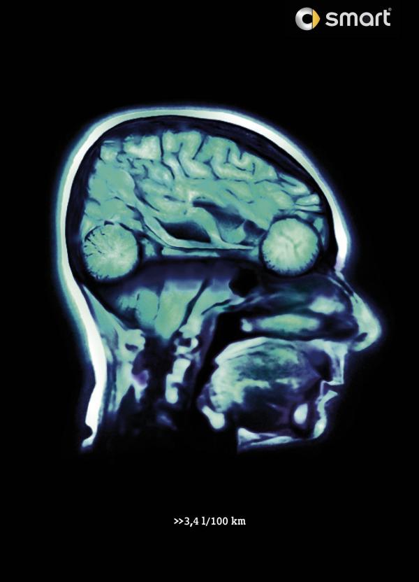 lp link smartcar brain.jpg